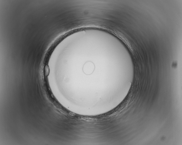 X0000116330676201001131025