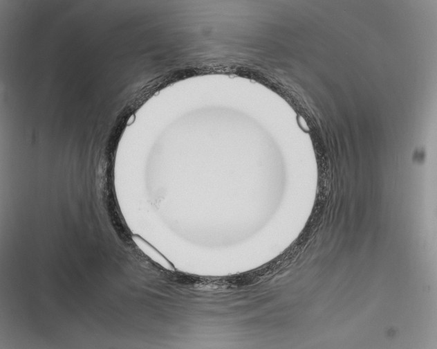 X0000116330693201001131025