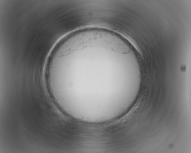 X0000116330832201001131022