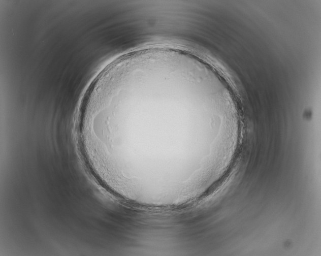 X0000116330836201001131022