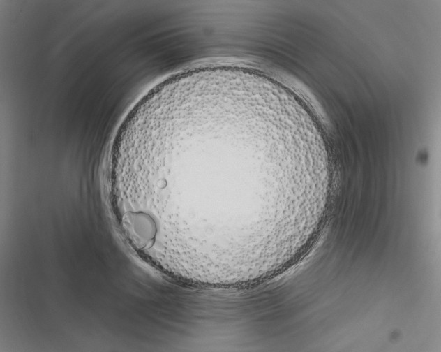 X0000116330844201001131023