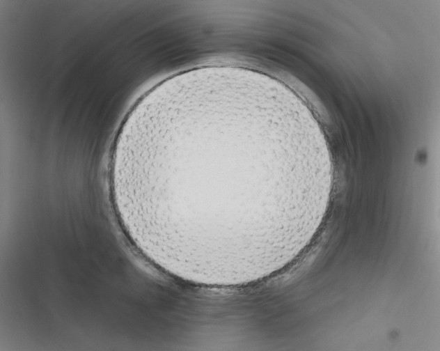 X0000116330854201001131023
