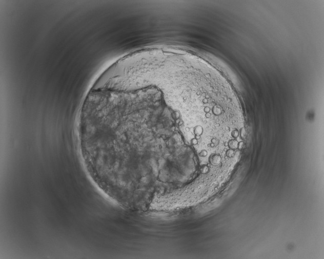 X0000116330855201001131023