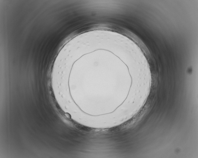 X0000116330858201001131023