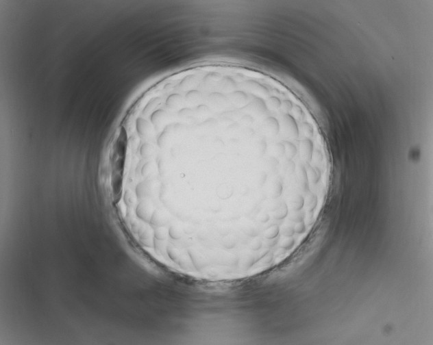 X0000116330862201001131023