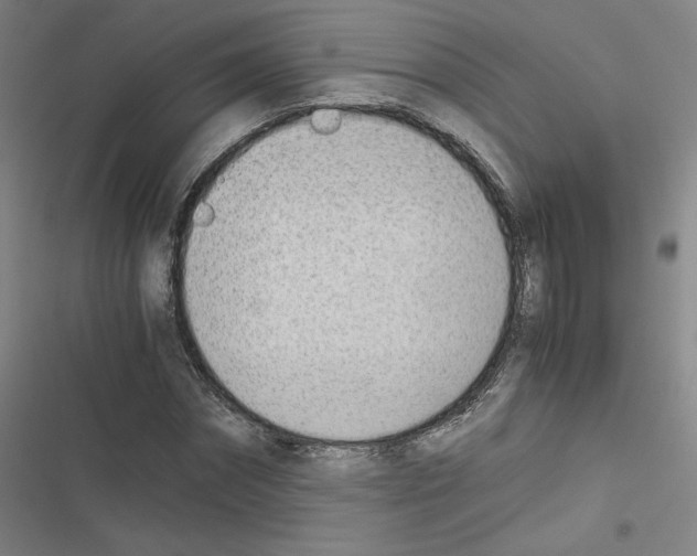 X0000116330874201001131022
