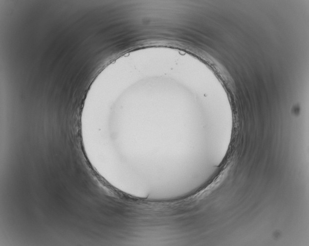 X0000116330993201001131020
