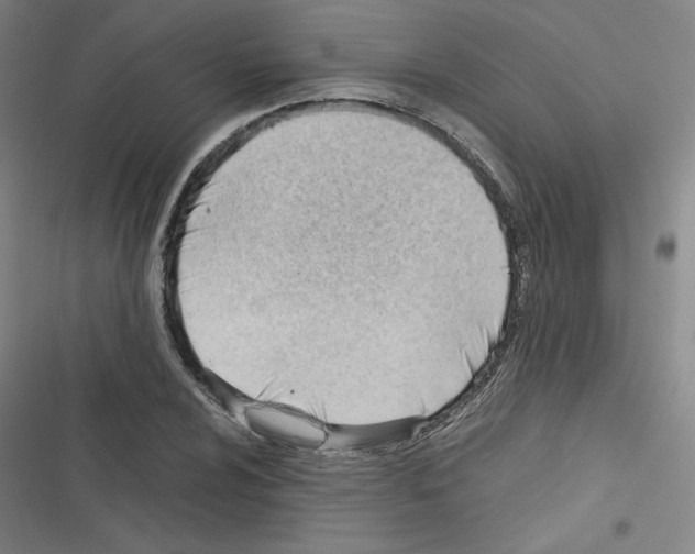 X0000116331024201001131020