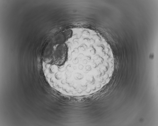 X0000116331106201001131018