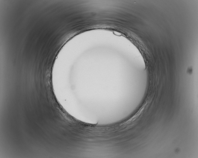 X0000116331177201001131018
