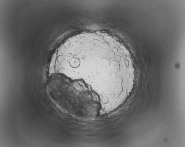 X0000116331205201001131017