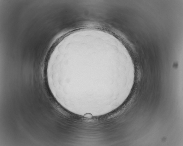 X0000116331222201001131017