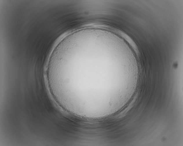 X0000116331338201001131016
