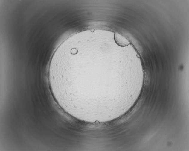 X0000116331386201001131015