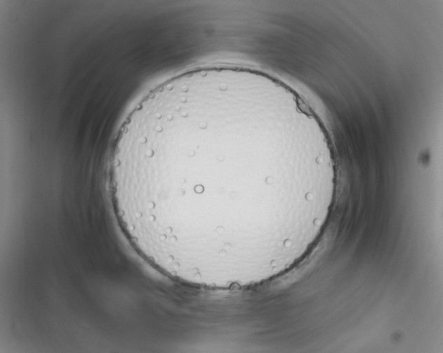 X0000116331390201001131015