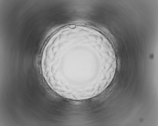 X0000116331412201001131015