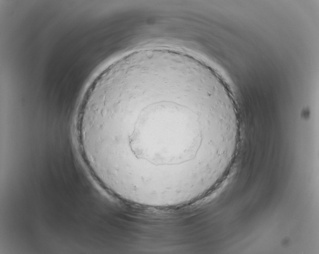 X0000116331517201001131013