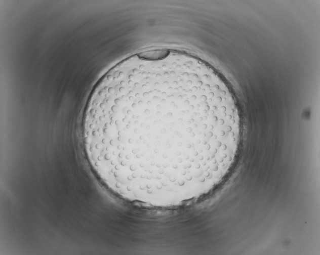 X0000116331521201001131014