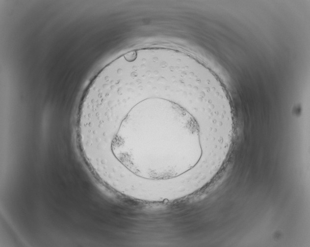 X0000116331525201001131014