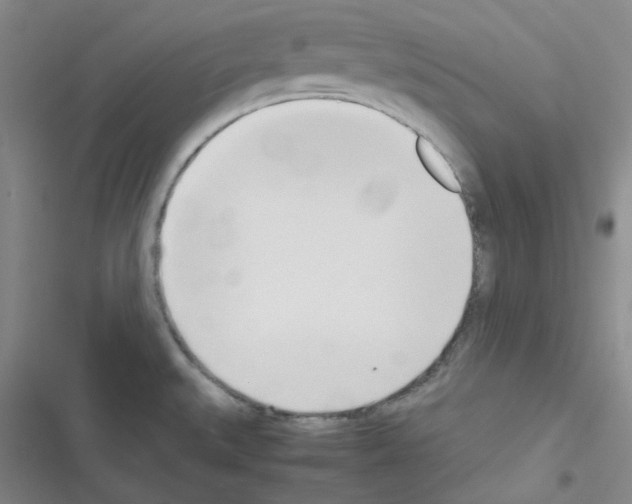 X0000116331527201001131014