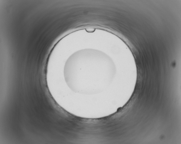 X0000116331534201001131014