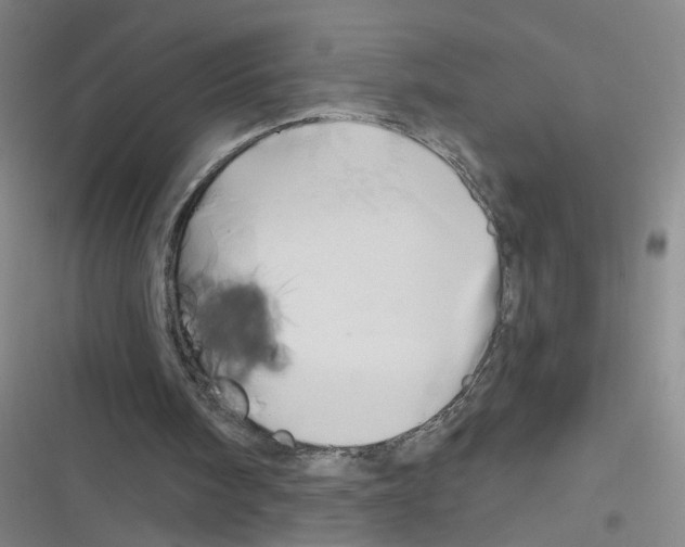 X0000116340098201001131054