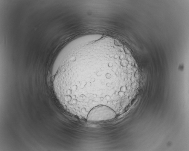 X0000116340175201001131053