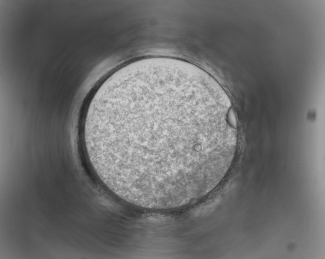 X0000116340199201001131052