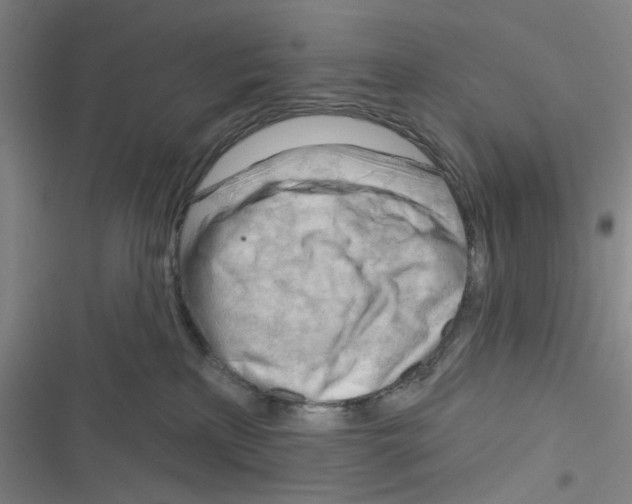 X0000116340233201001131052