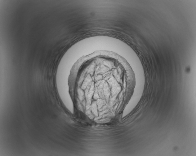 X0000116340235201001131052