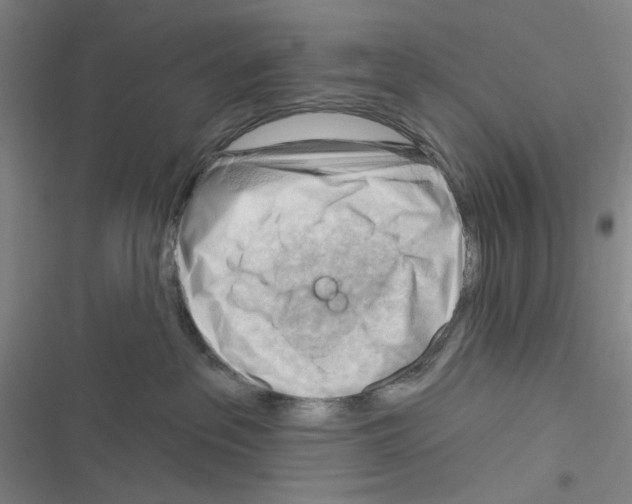 X0000116340237201001131052