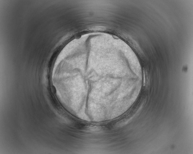 X0000116340300201001131051