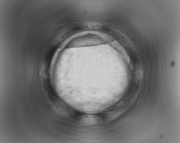 X0000116340316201001131051