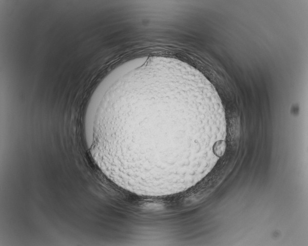 X0000116340653201001131046