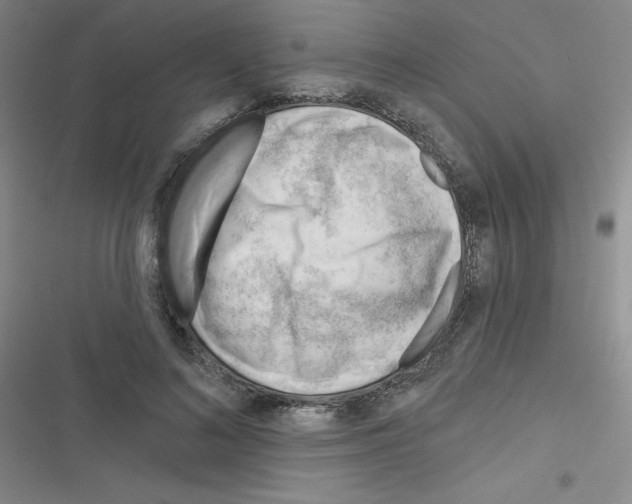 X0000116340692201001131045