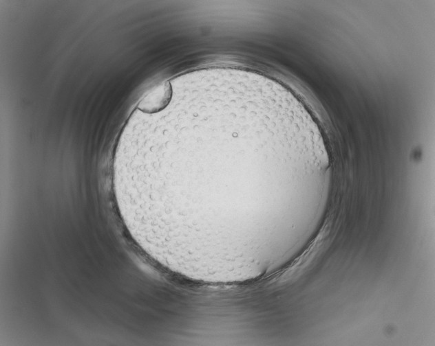 X0000116340858201001131044