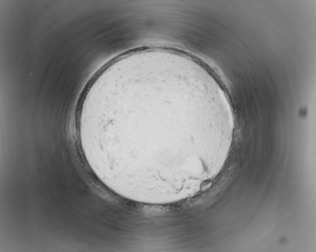 X0000116340887201001131043