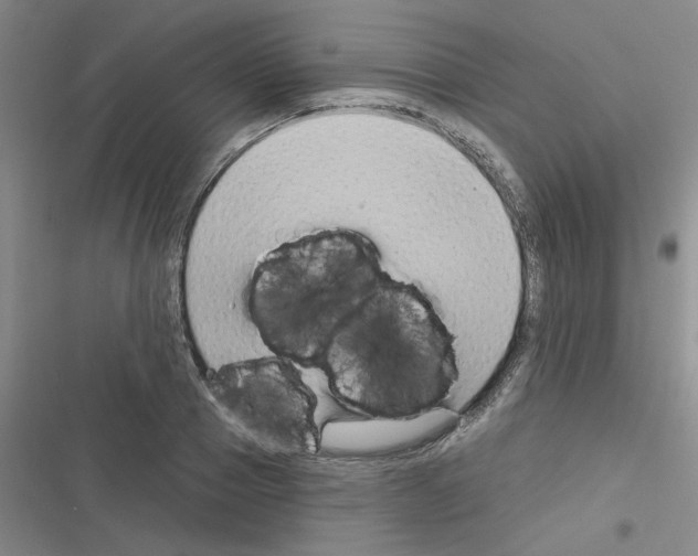 X0000116340937201001131042