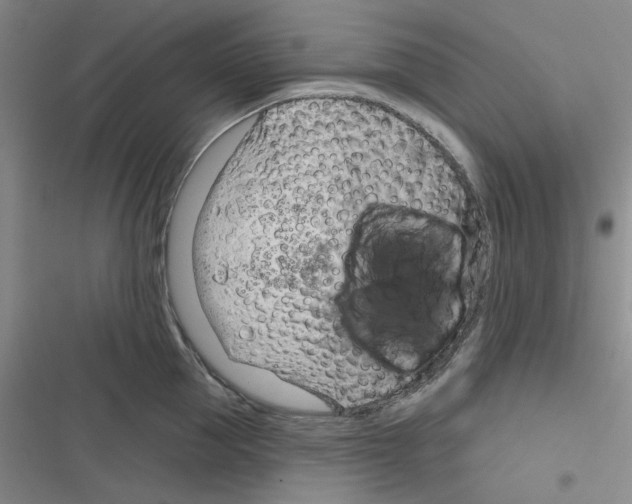 X0000116340953201001131042