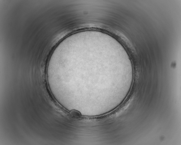 X0000116340977201001131042