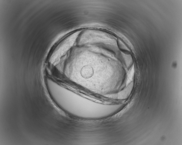 X0000116340989201001131041