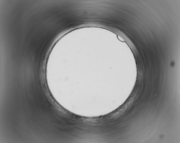 X0000116341004201001131041