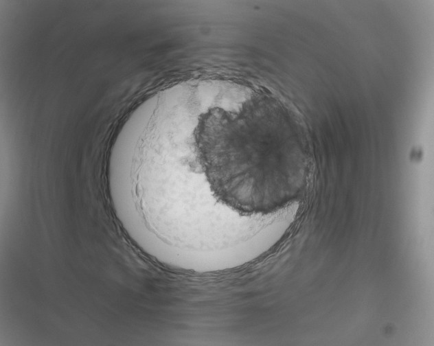 X0000116341009201001131041