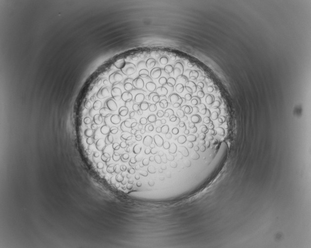 X0000116341022201001131041