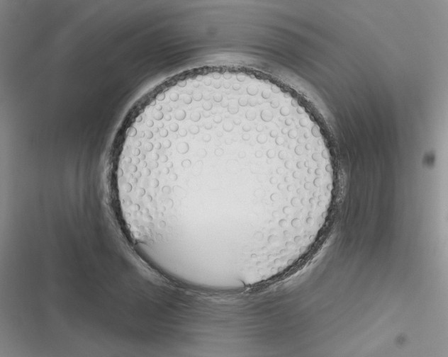 X0000116341029201001131041