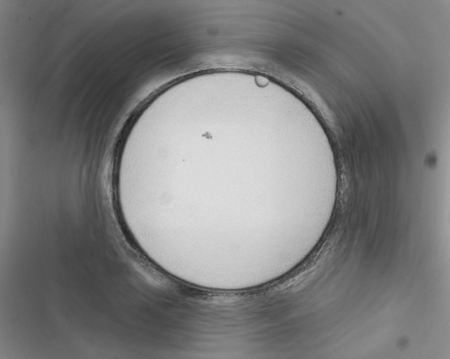 X0000116341035201001131041