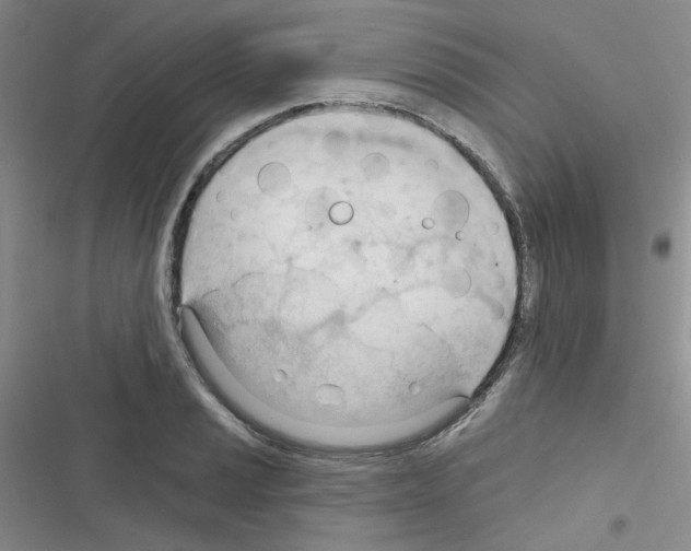 X0000116341037201001131041