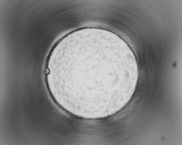 X0000116341045201001131041