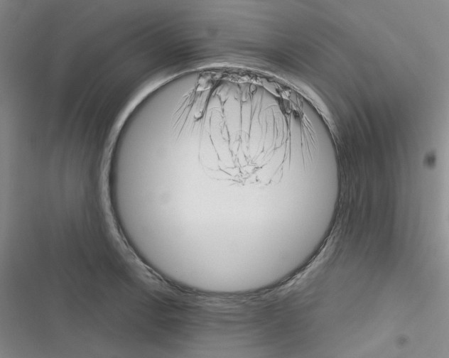 X0000116341138201001131040