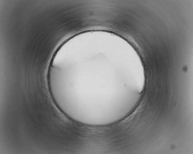 X0000116341181201001131039